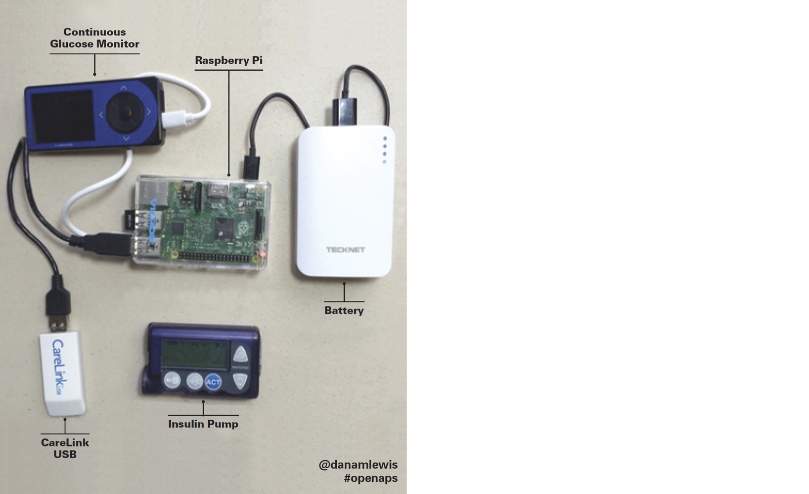 DIY Artificial Pancreas